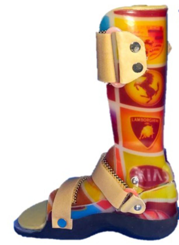 best-prosthetics-and-orthotics-back-up-limbs