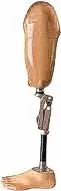 above-knee-artificial-limb-mumbai