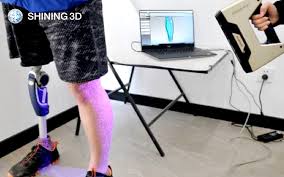 3d-printed-prosthesis-near-mumbai