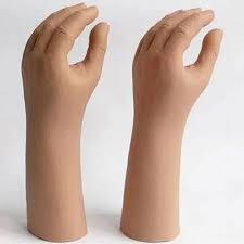 upper-limb-prosthetic-artificial-hand-mahim