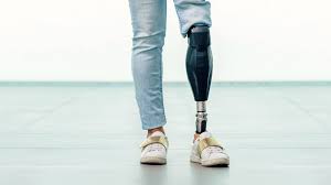 best-artificial-leg-manufacturer-in-pune