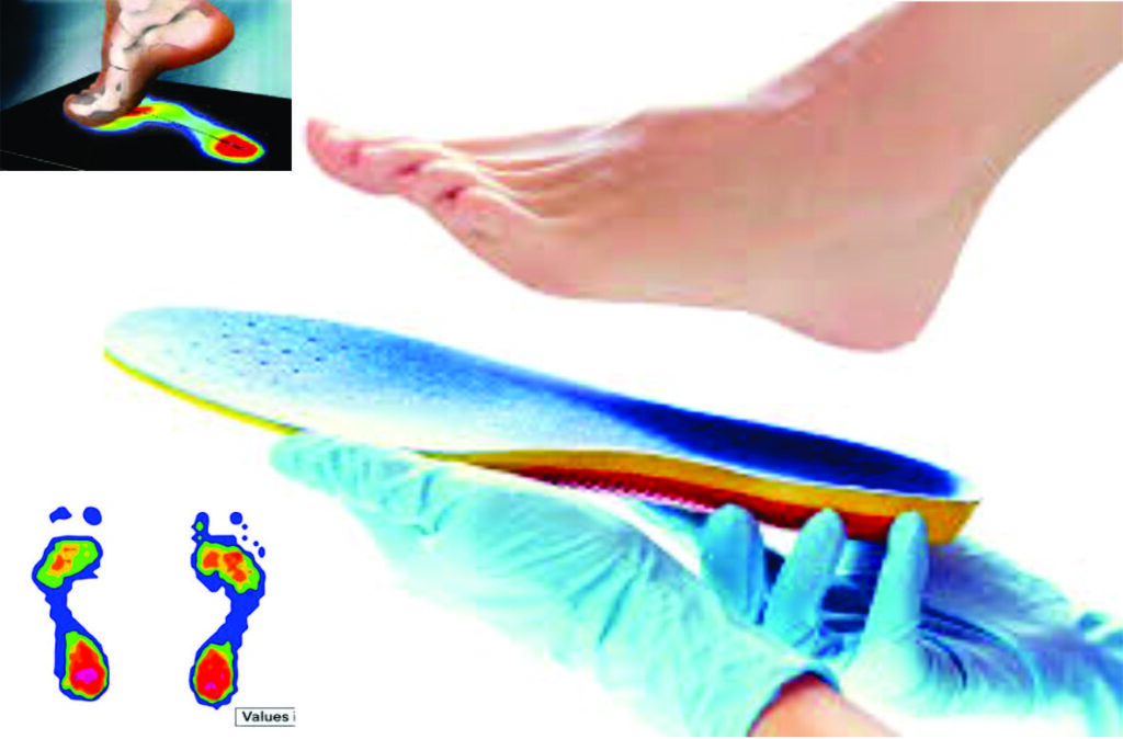 best-podia-scan-insole-near-me-flat-foot-insole
