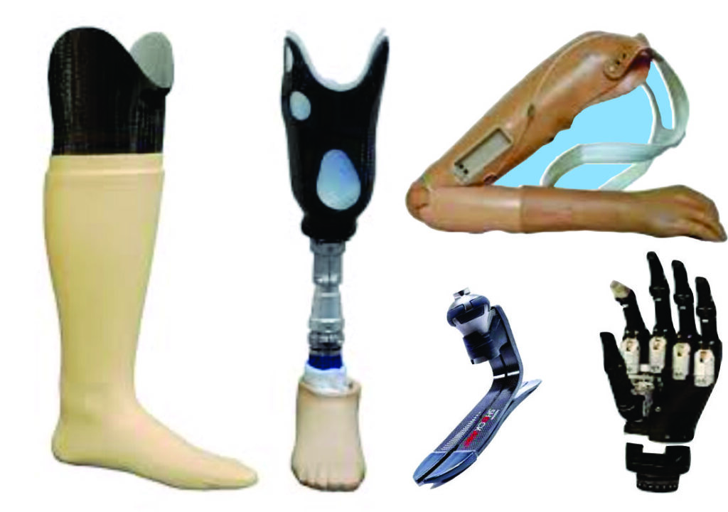 upper-limb-prosthetic-artificial-hand-airoli