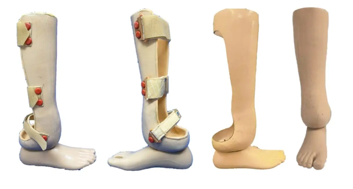 partial-foot-prostheses-mumbai