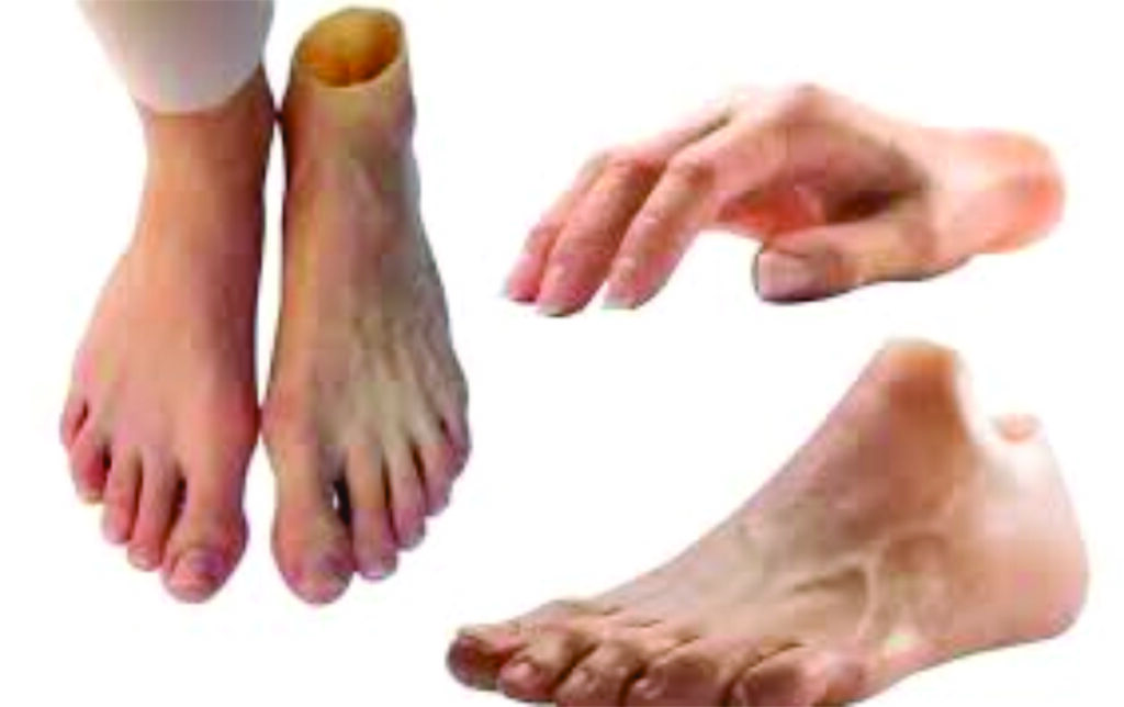 best-prosthetics-artificial-leg-near-dombivli